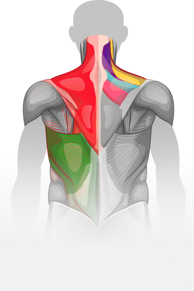 Neck strain image graphic,